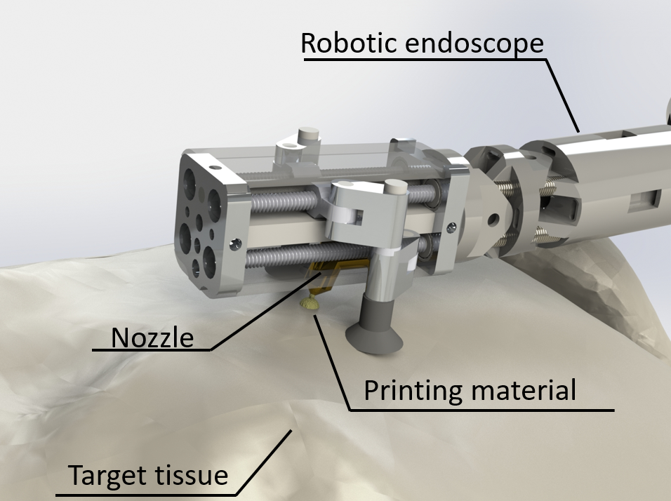 Miniature robot for minimally invasive 3D printing