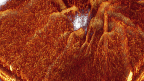 Ophtalmic Imaging Group