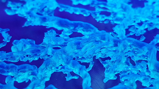 3D print of healthy choroidal vessels