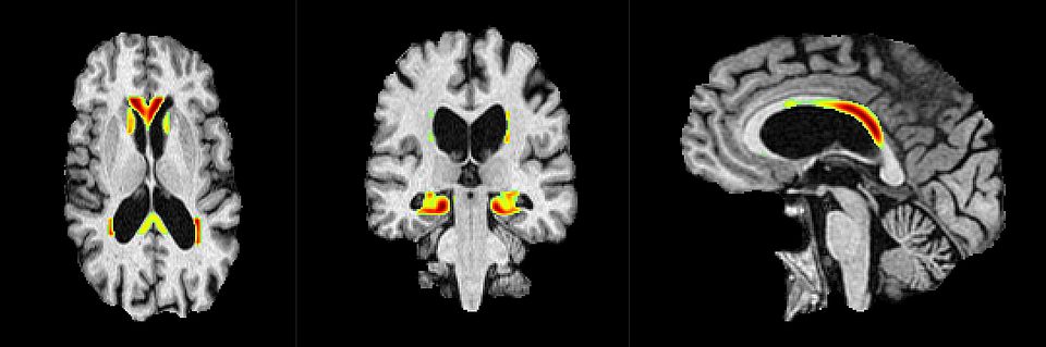 Automatic Detection of Neurological Anomalies