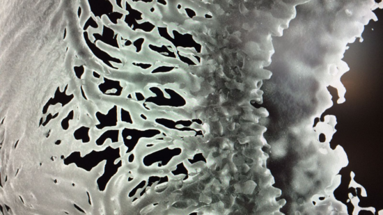 inner iris vessels in 3D