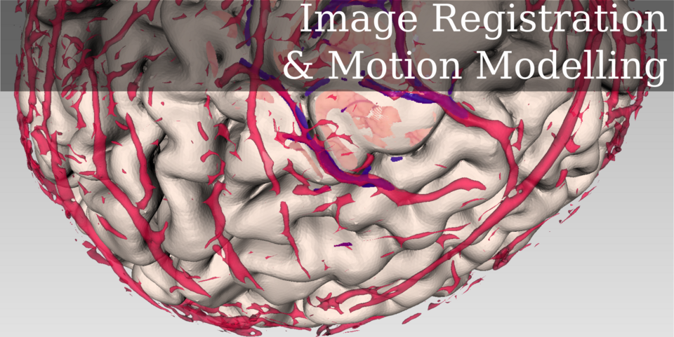 Improving Cranial Navigation with an Advanced Microscope 