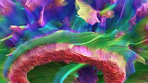 Translational Imaging in Neurology (ThINk)