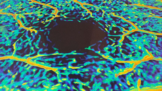 vessel free human fovea (avascular zone) volume rendered