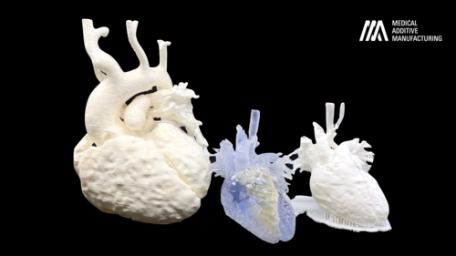 Bioresorbable Personalized Implants