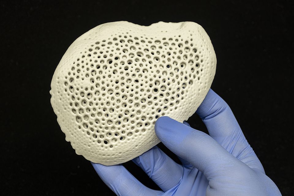 PEEK Implant 3D Printed