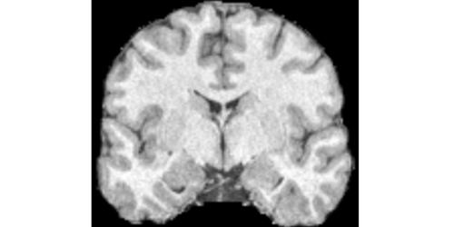 Contrast Harmonization of Magnetic Resonance Images