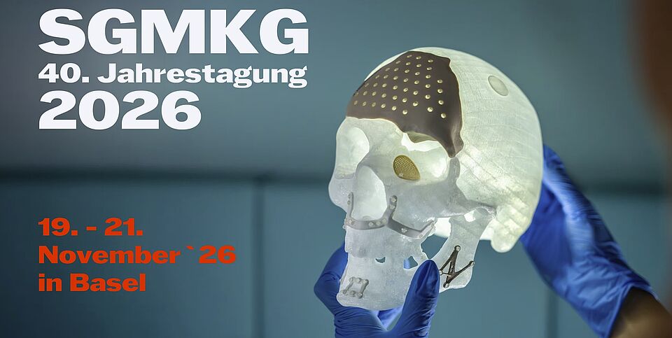 SGMKG