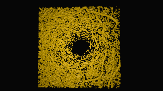 volume rendered human fovea vessels