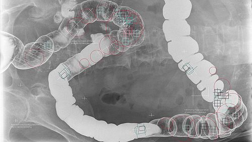 Surgical Artificial Intelligence Lab (SAIL)