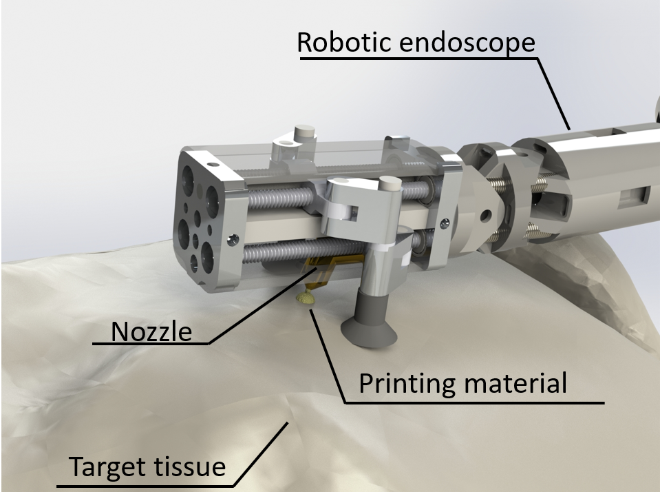 Miniature robot for minimally invasive 3D printing