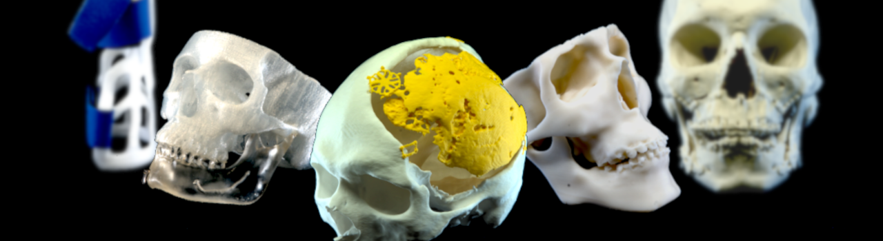 FDM 3D Printed Anatomical Models
